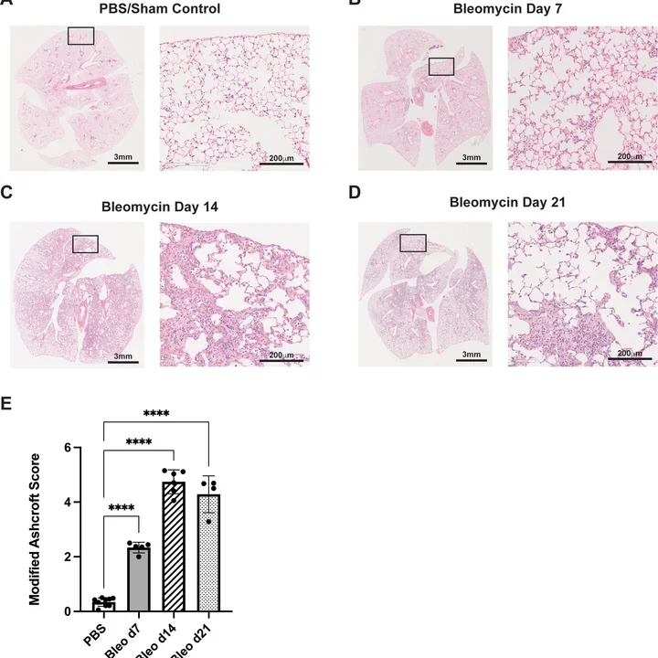 Bleomycin results for time course